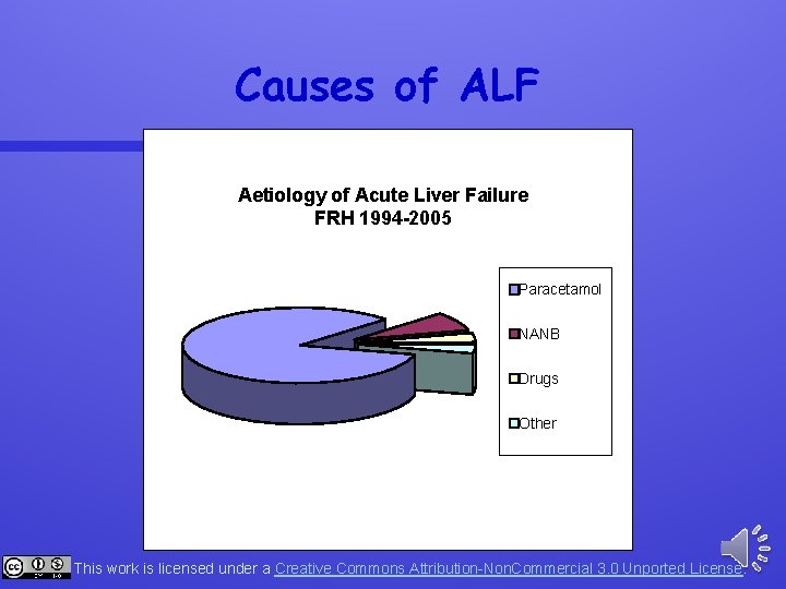 Causes of ALF Aetiology of Acute Liver Failure FRH 1994 -2005 Paracetamol NANB Drugs