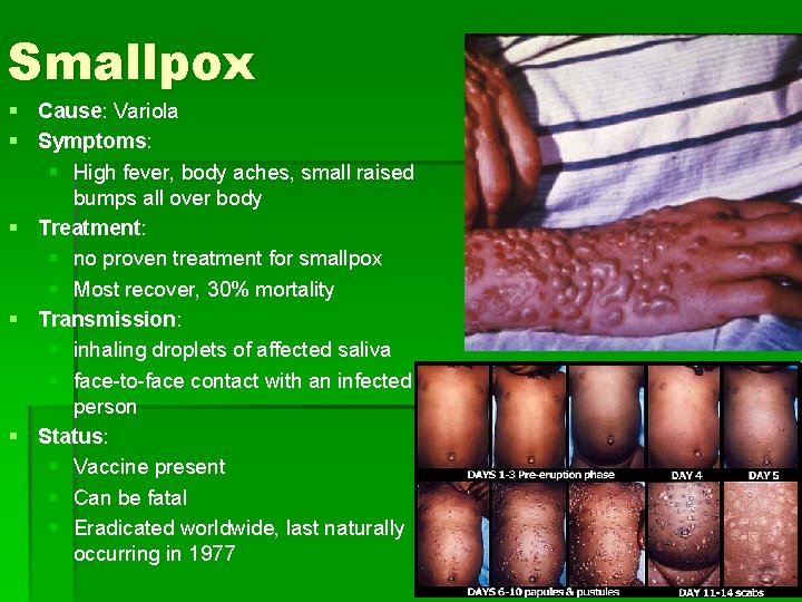 Smallpox § Cause: Variola § Symptoms: § High fever, body aches, small raised bumps