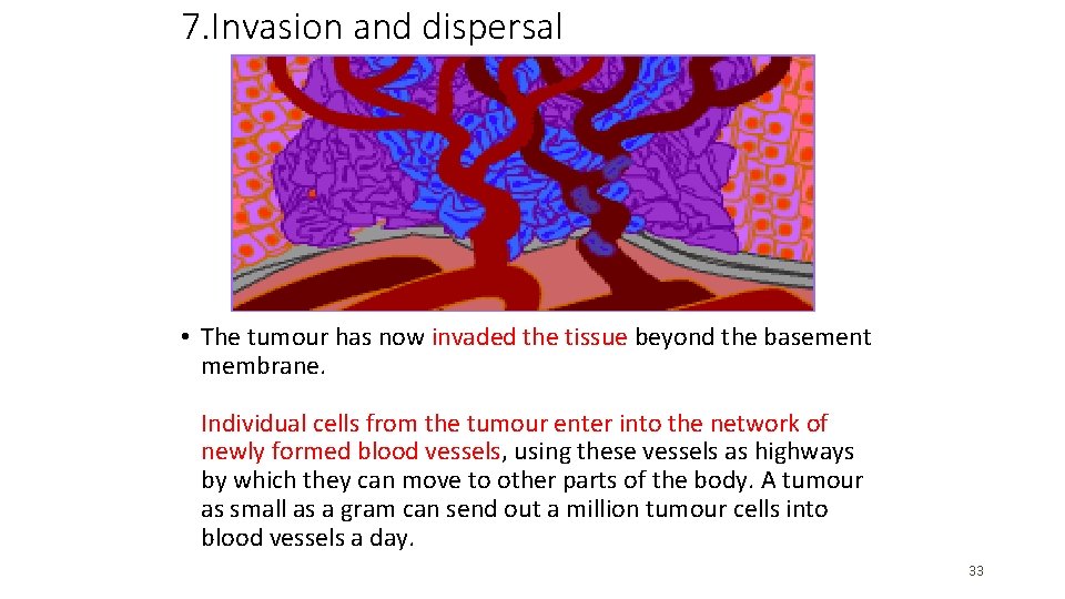 7. Invasion and dispersal • The tumour has now invaded the tissue beyond the 7. Invasion and dispersal • The tumour has now invaded the tissue beyond the