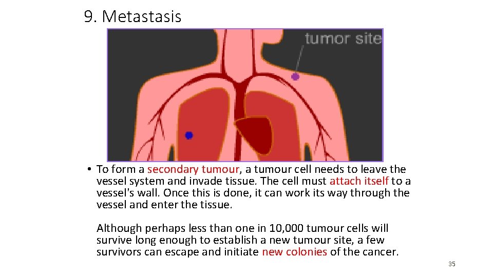 9. Metastasis • To form a secondary tumour, a tumour cell needs to leave 9. Metastasis • To form a secondary tumour, a tumour cell needs to leave