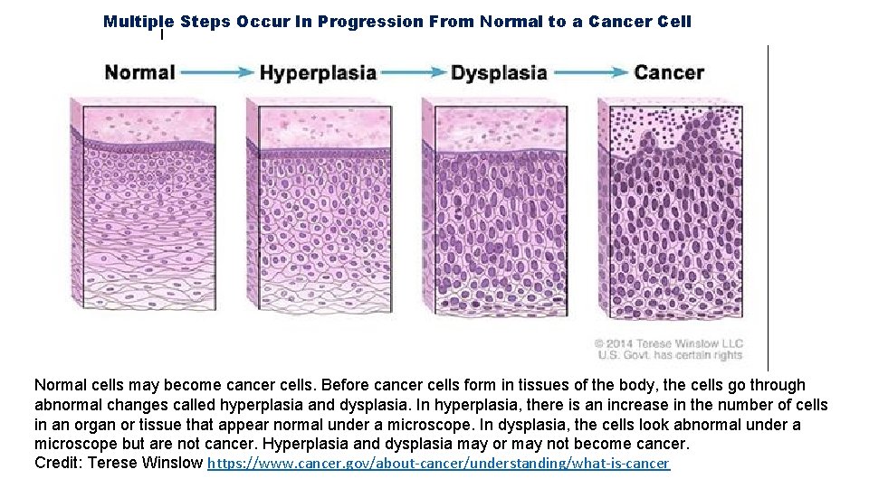 Multiple Steps Occur In Progression From Normal to a Cancer Cell l Normal cells Multiple Steps Occur In Progression From Normal to a Cancer Cell l Normal cells