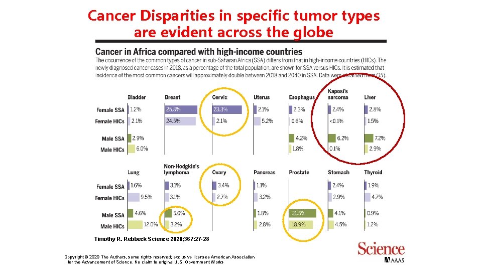 Cancer Disparities in specific tumor types are evident across the globe Timothy R. Rebbeck Cancer Disparities in specific tumor types are evident across the globe Timothy R. Rebbeck