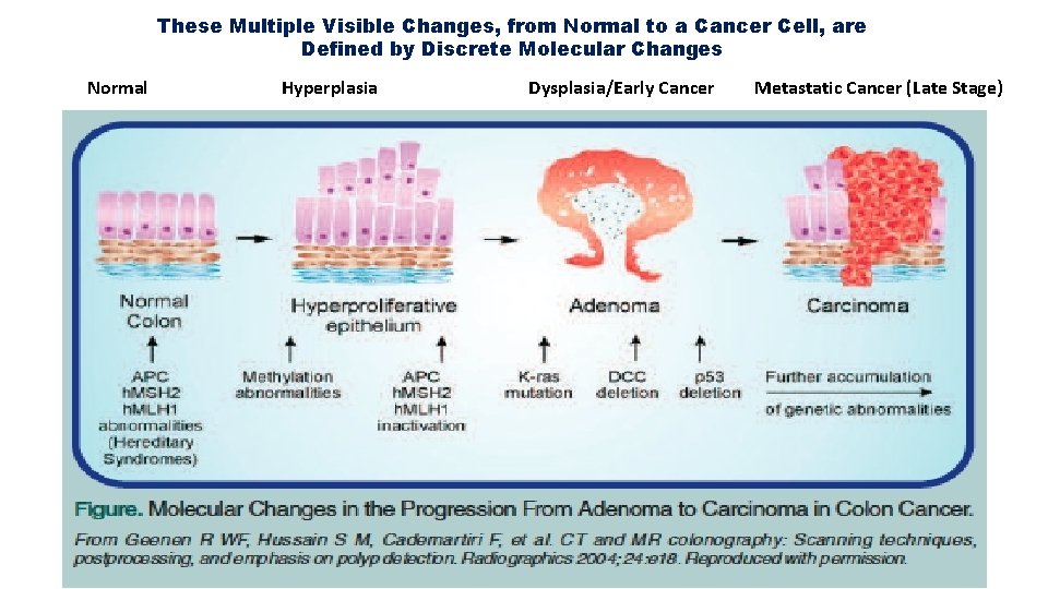 These Multiple Visible Changes, from Normal to a Cancer Cell, are Defined by Discrete These Multiple Visible Changes, from Normal to a Cancer Cell, are Defined by Discrete