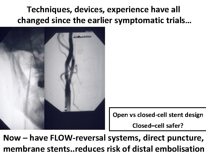 Techniques, devices, experience have all changed since the earlier symptomatic trials… Open vs closed-cell