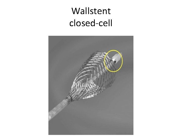 Wallstent closed-cell 