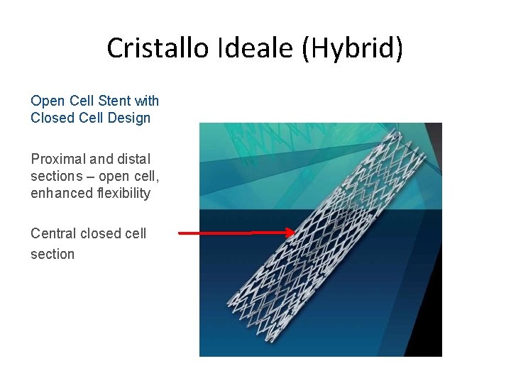 Cristallo Ideale (Hybrid) Open Cell Stent with Closed Cell Design Proximal and distal sections