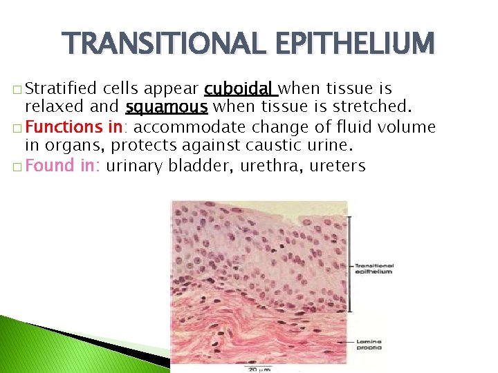 TRANSITIONAL EPITHELIUM � Stratified cells appear cuboidal when tissue is relaxed and squamous when