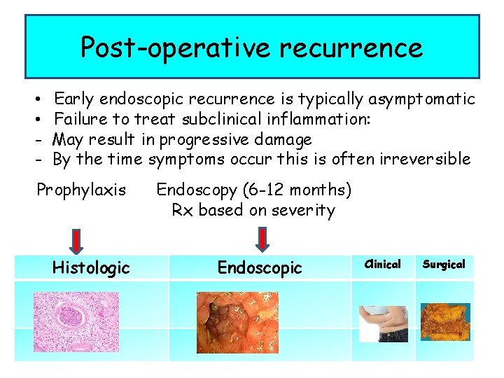 Post-operative recurrence • • - Early endoscopic recurrence is typically asymptomatic Failure to treat