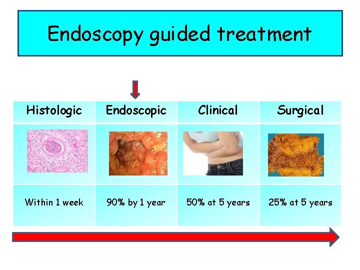 Endoscopy guided treatment Histologic Endoscopic Clinical Surgical Within 1 week 90% by 1 year