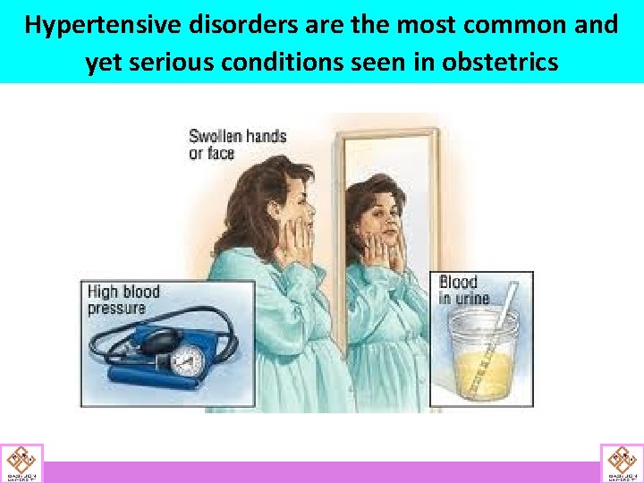 Hypertensive disorders are the most common and yet serious conditions seen in obstetrics 