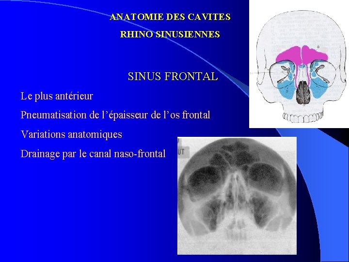 ANATOMIE DES CAVITES RHINO SINUSIENNES SINUS FRONTAL Le plus antérieur Pneumatisation de l’épaisseur de