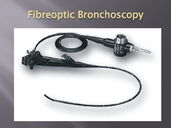 Fibreoptic Bronchoscopy 