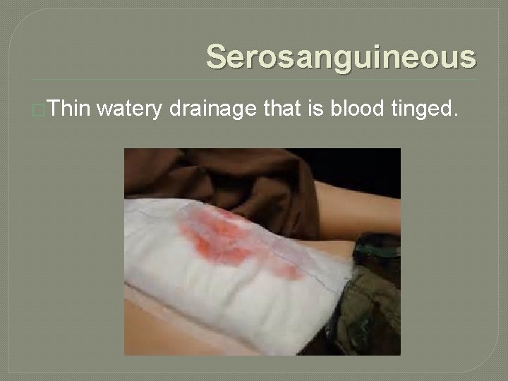 Serosanguineous �Thin watery drainage that is blood tinged. 