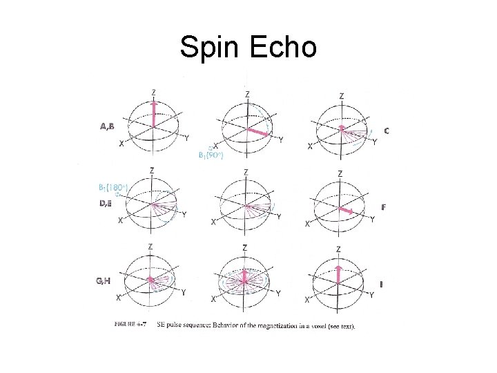 Spin Echo 