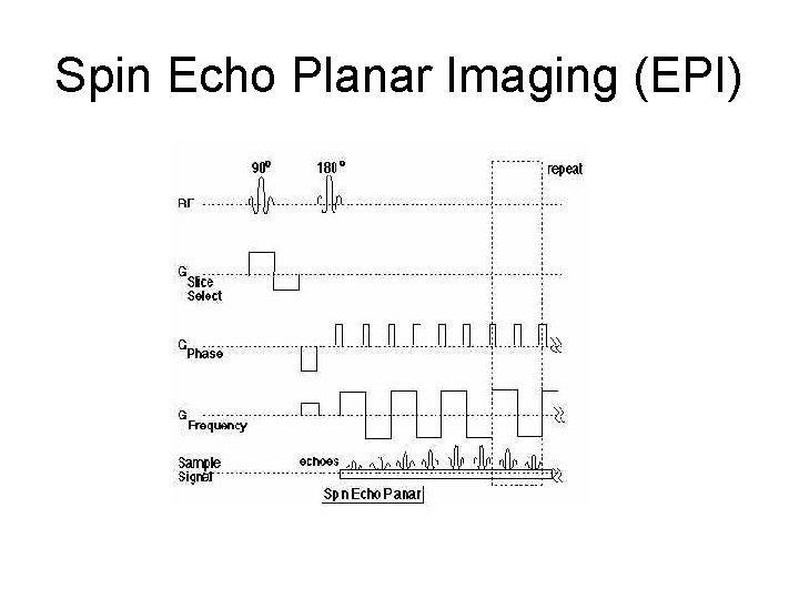 Spin Echo Planar Imaging (EPI) 