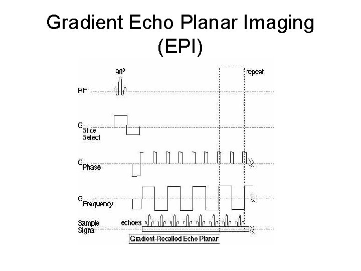 Gradient Echo Planar Imaging (EPI) 