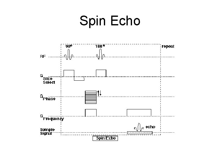 Spin Echo 