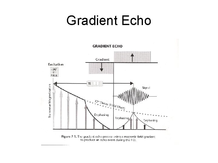 Gradient Echo 