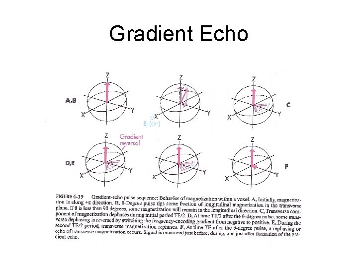 Gradient Echo 