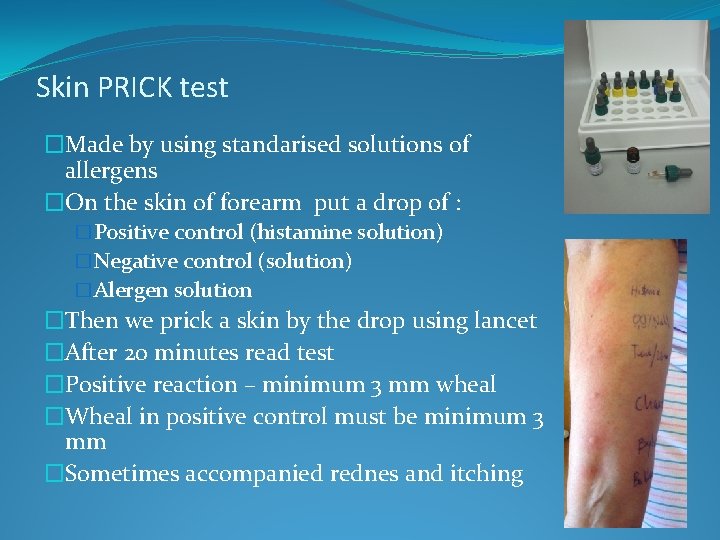 Skin PRICK test �Made by using standarised solutions of allergens �On the skin of