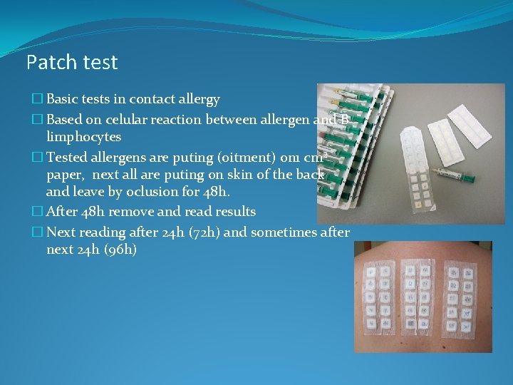 Patch test � Basic tests in contact allergy � Based on celular reaction between