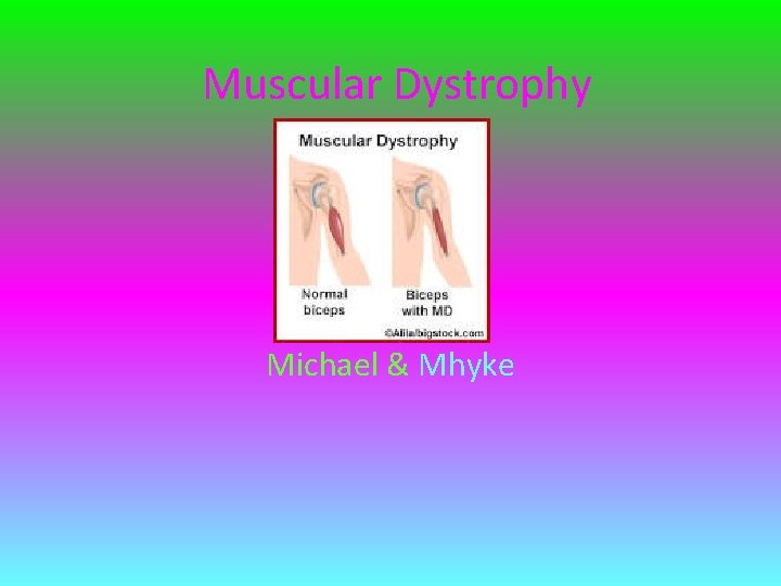 Muscular Dystrophy Michael & Mhyke 
