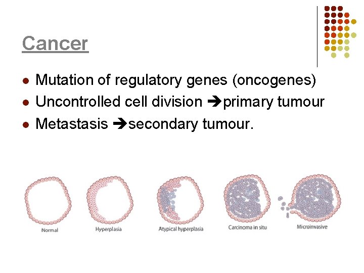 Cancer l l l Mutation of regulatory genes (oncogenes) Uncontrolled cell division primary tumour