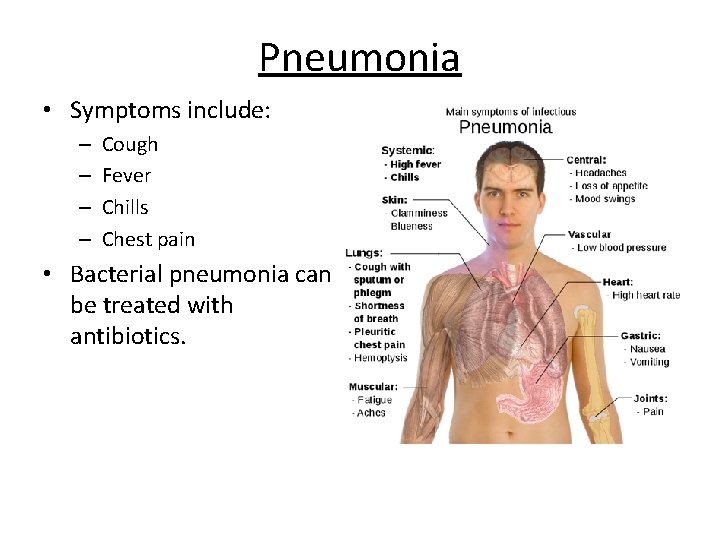 Pneumonia • Symptoms include: – – Cough Fever Chills Chest pain • Bacterial pneumonia