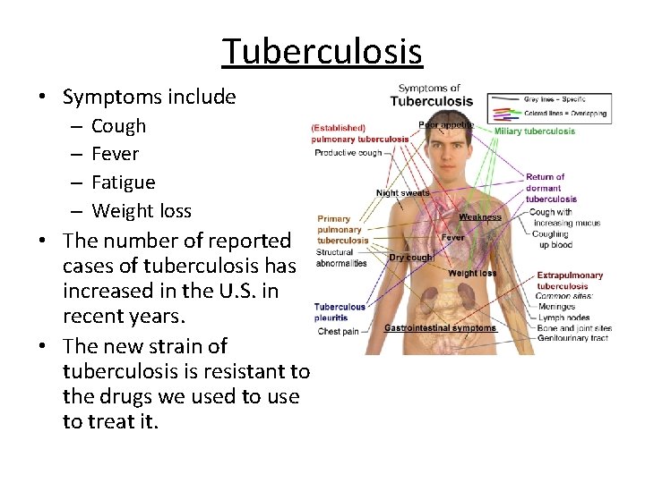 Tuberculosis • Symptoms include – – Cough Fever Fatigue Weight loss • The number