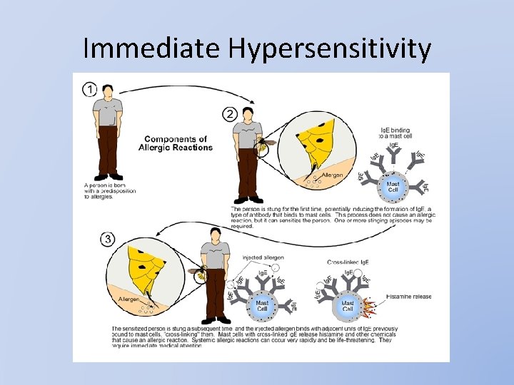 Immediate Hypersensitivity 