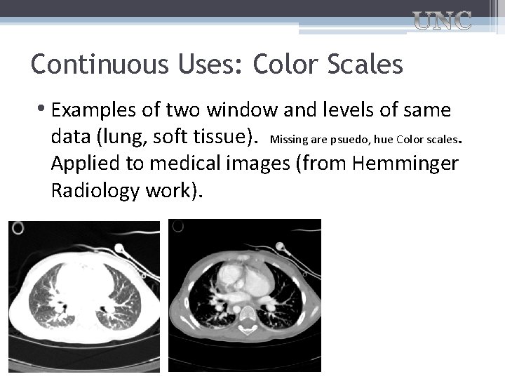 Continuous Uses: Color Scales • Examples of two window and levels of same data