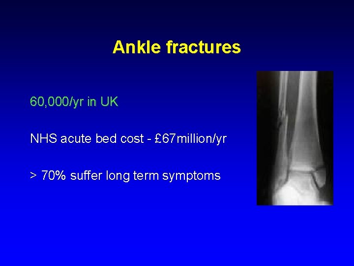 Ankle fractures 60, 000/yr in UK NHS acute bed cost - £ 67 million/yr