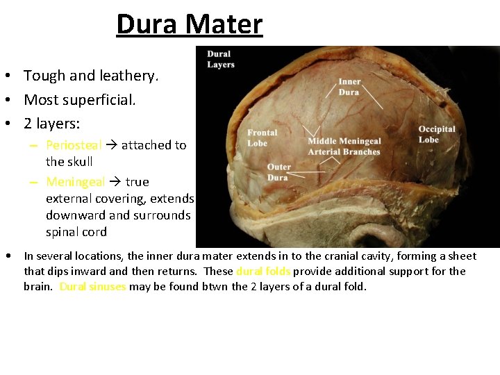 Dura Mater • Tough and leathery. • Most superficial. • 2 layers: – Periosteal