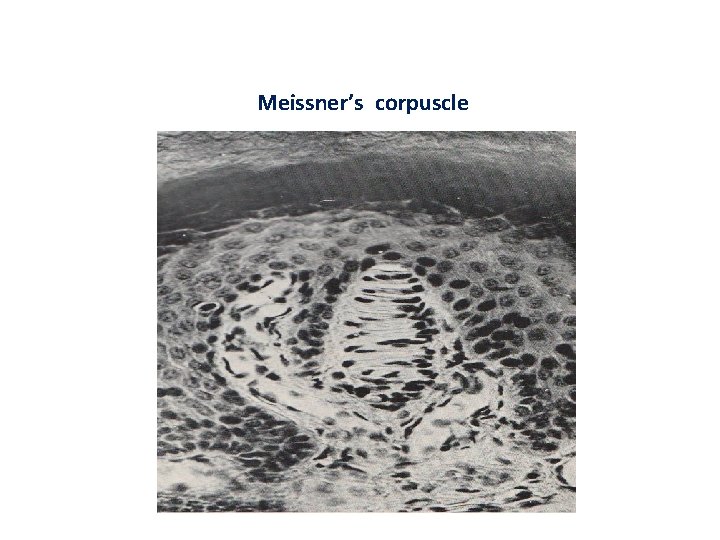 Meissner’s corpuscle 