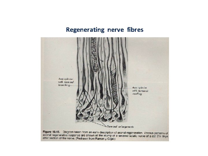 Regenerating nerve fibres 