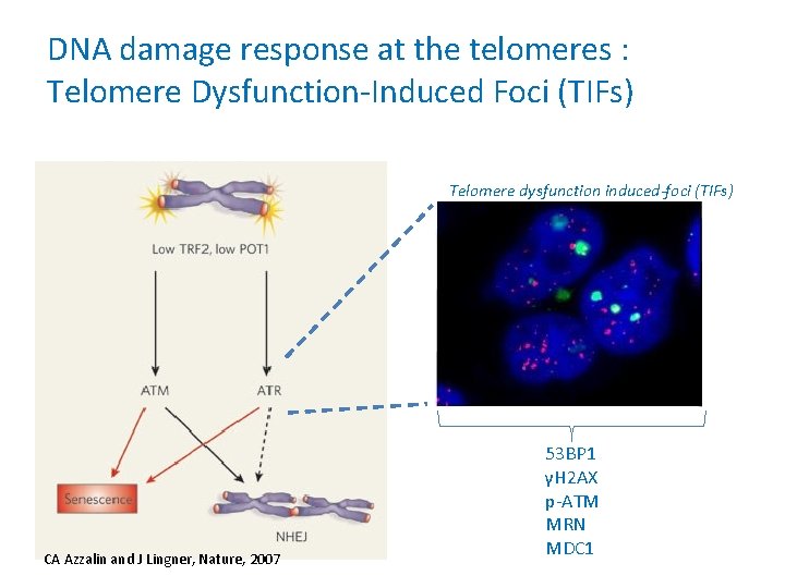 DNA damage response at the telomeres : Telomere Dysfunction-Induced Foci (TIFs) Telomere dysfunction induced-foci