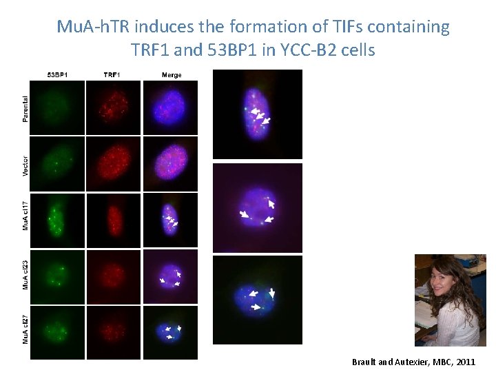 Mu. A-h. TR induces the formation of TIFs containing TRF 1 and 53 BP