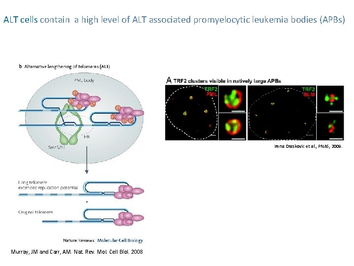 ALT cells contain a high level of ALT associated promyelocytic leukemia bodies (APBs) Irena