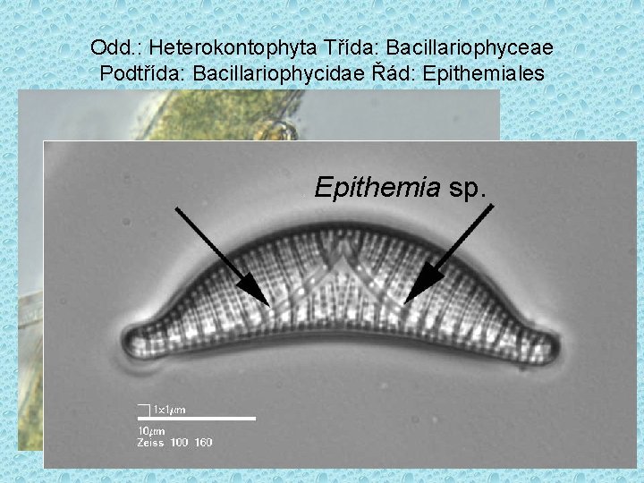 Odd. : Heterokontophyta Třída: Bacillariophyceae Podtřída: Bacillariophycidae Řád: Epithemiales Epithemia sp. 