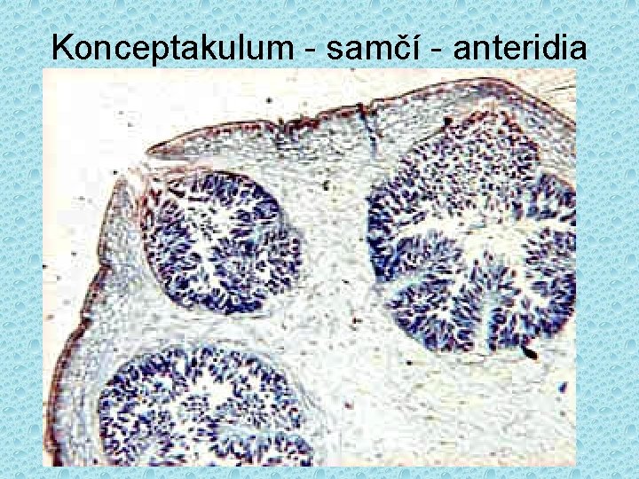 Konceptakulum - samčí - anteridia 