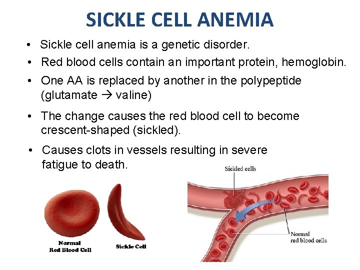 SICKLE CELL ANEMIA • Sickle cell anemia is a genetic disorder. • Red blood