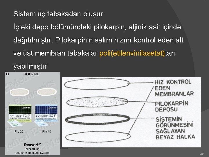 Sistem üç tabakadan oluşur İçteki depo bölümündeki pilokarpin, aljinik asit içinde dağıtılmıştır. Pilokarpinin salım