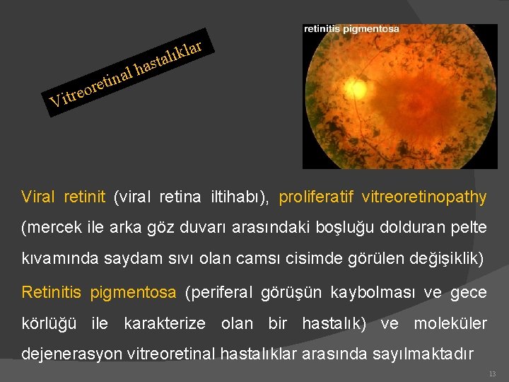 r l a n i et r o e r la k ı l