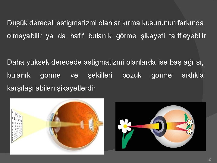 Düşük dereceli astigmatizmi olanlar kırma kusurunun farkında olmayabilir ya da hafif bulanık görme şikayeti