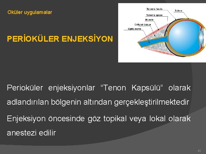 Oküler uygulamalar PERİOKÜLER ENJEKSİYON Perioküler enjeksiyonlar “Tenon Kapsülü” olarak adlandırılan bölgenin altından gerçekleştirilmektedir Enjeksiyon