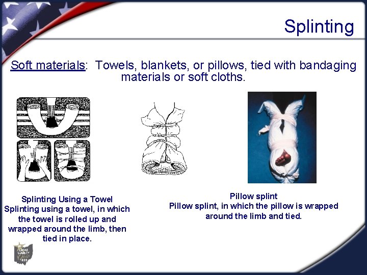 Splinting Soft materials: Towels, blankets, or pillows, tied with bandaging materials or soft cloths.