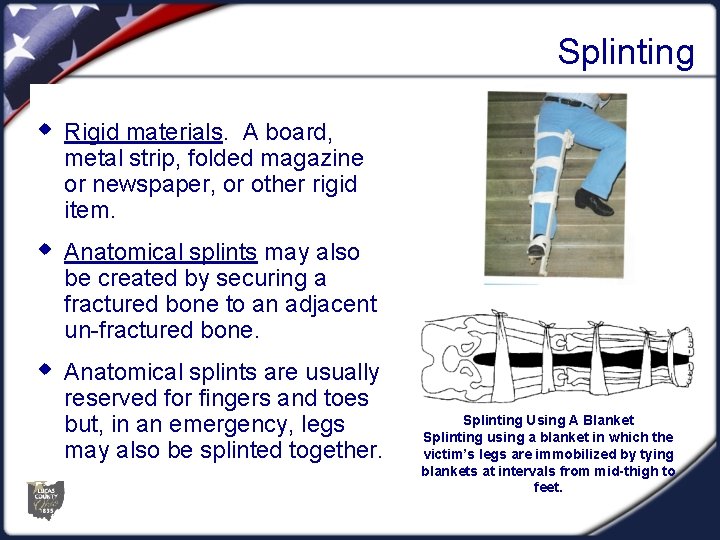 Splinting w Rigid materials. A board, metal strip, folded magazine or newspaper, or other