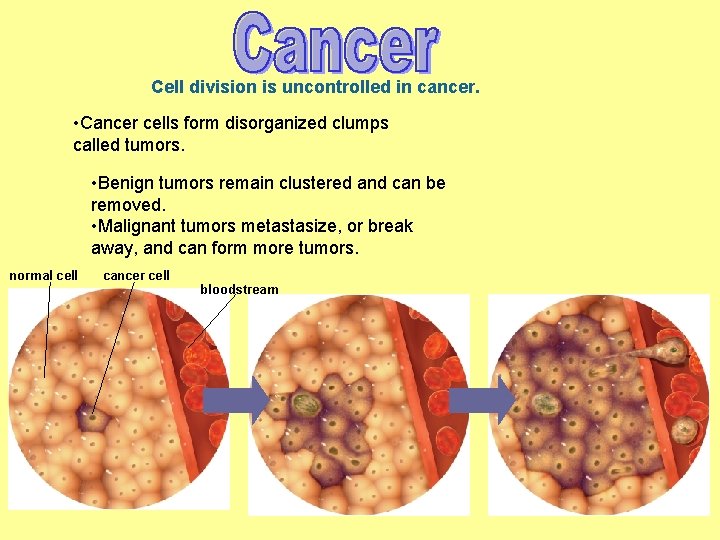 Cell division is uncontrolled in cancer. • Cancer cells form disorganized clumps called tumors.