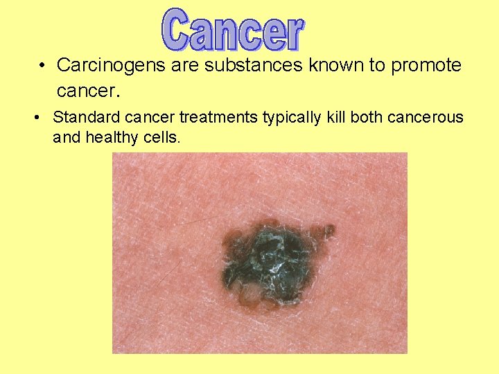  • Carcinogens are substances known to promote cancer. • Standard cancer treatments typically