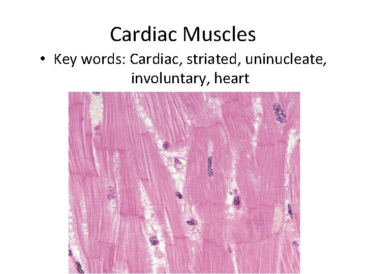Cardiac Muscles • Key words: Cardiac, striated, uninucleate, involuntary, heart 